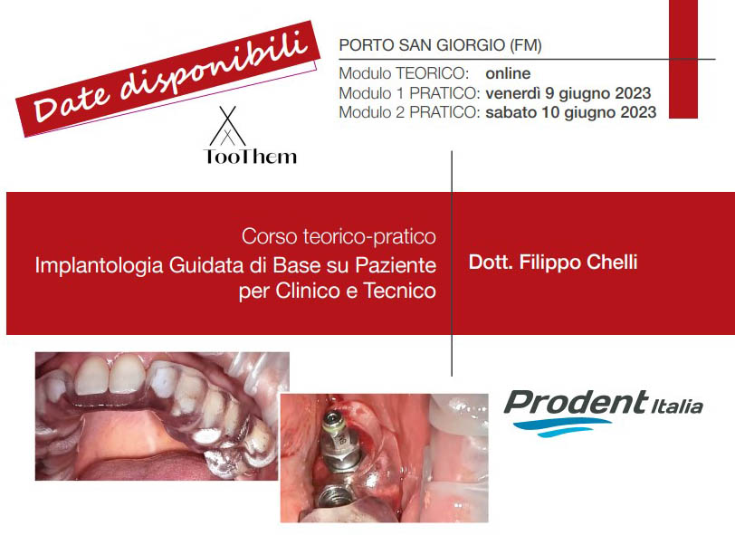 Corso teorico-pratico Implantologia Guidata di Base su Paziente per Clinico e Tecnico